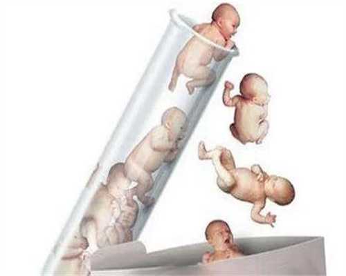 杭州试管婴儿助孕_杭州代孕合法_做人家代孕值多少钱_代孕需多少钱