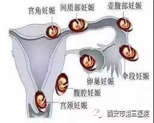 杭州代孕成功率_国内那里有靠谱代孕
