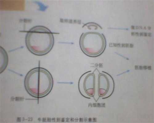 不孕不育供卵试管助孕_杭州代生是什么意思_如果在怀孕期间发现肾结石怎么办
